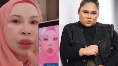 Photo of DSV Mahu Buat Pembedahan Plastik Untuk Kelihatan Seperti Barbie Doll, Cik B Larang & Tegaskan Ia Perbuatan Berdosa